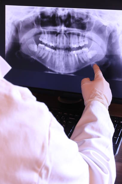 Best Emergency Denture Repair in Deer Park, OH